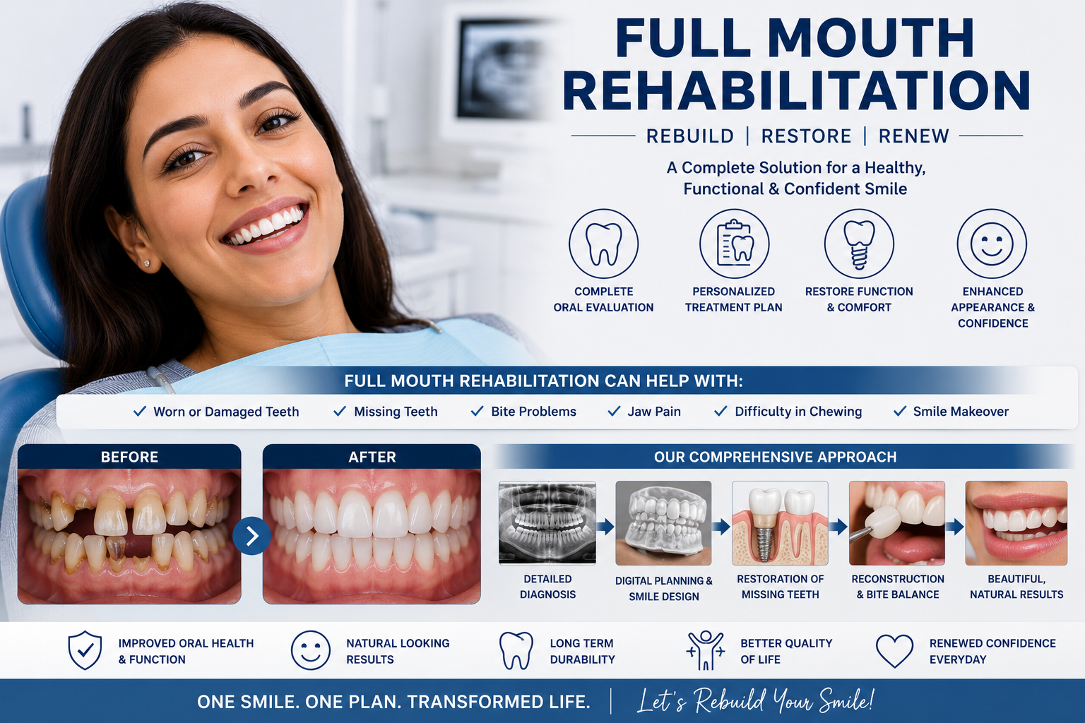 Full Mouth Rehabilitation